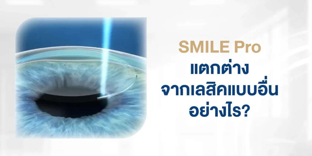 SMILE Pro ต่างจากเลสิคแบบอื่นอย่างไร