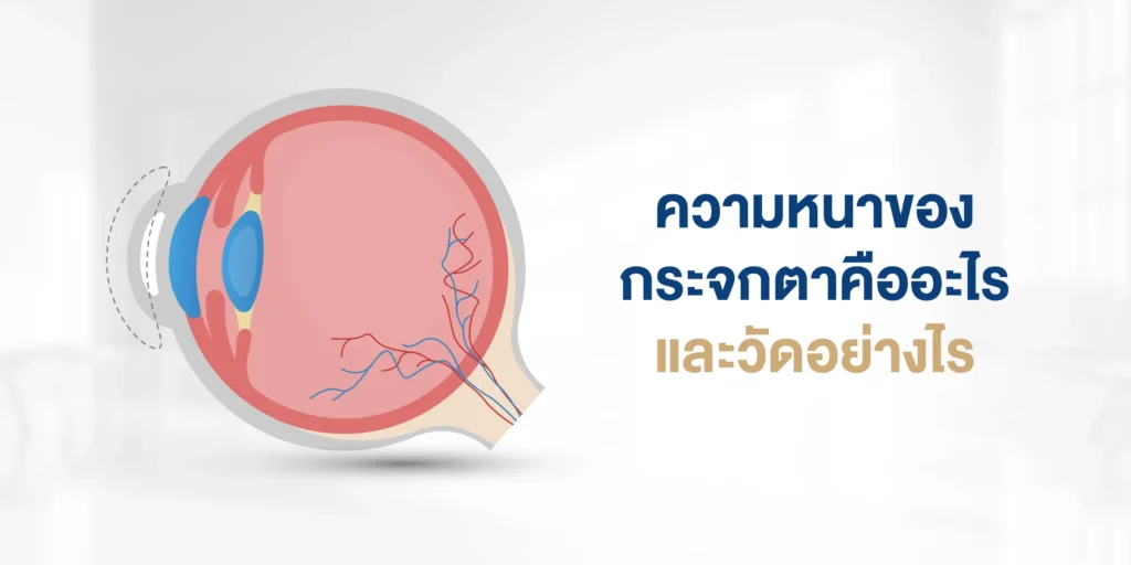 ความหนาของกระจกตาคืออะไร และวัดอย่างไร