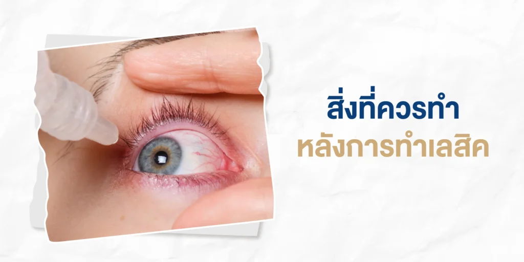 สิ่งที่ควรทำหลังการทำเลสิค