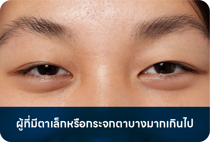 ไม่เหมาะกับผู้ที่มีตาเล็ก