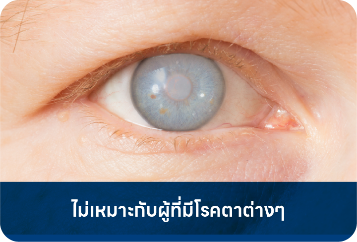 ไม่เหมาะกับผู้ที่มีโรคตา