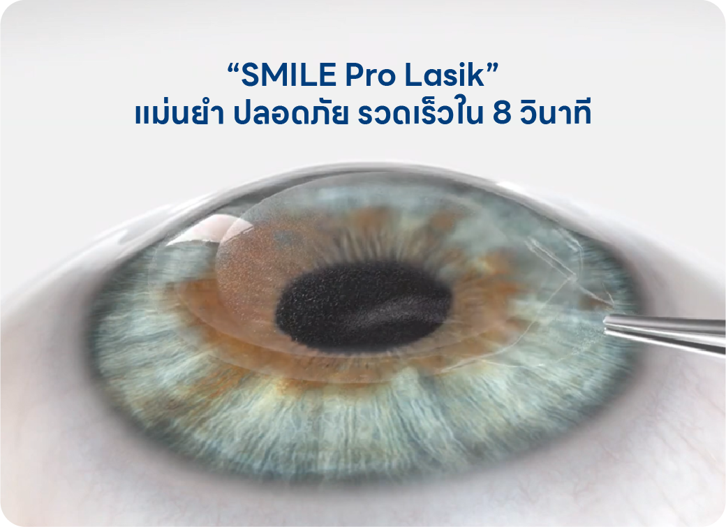 SMILE Pro คืออะไร