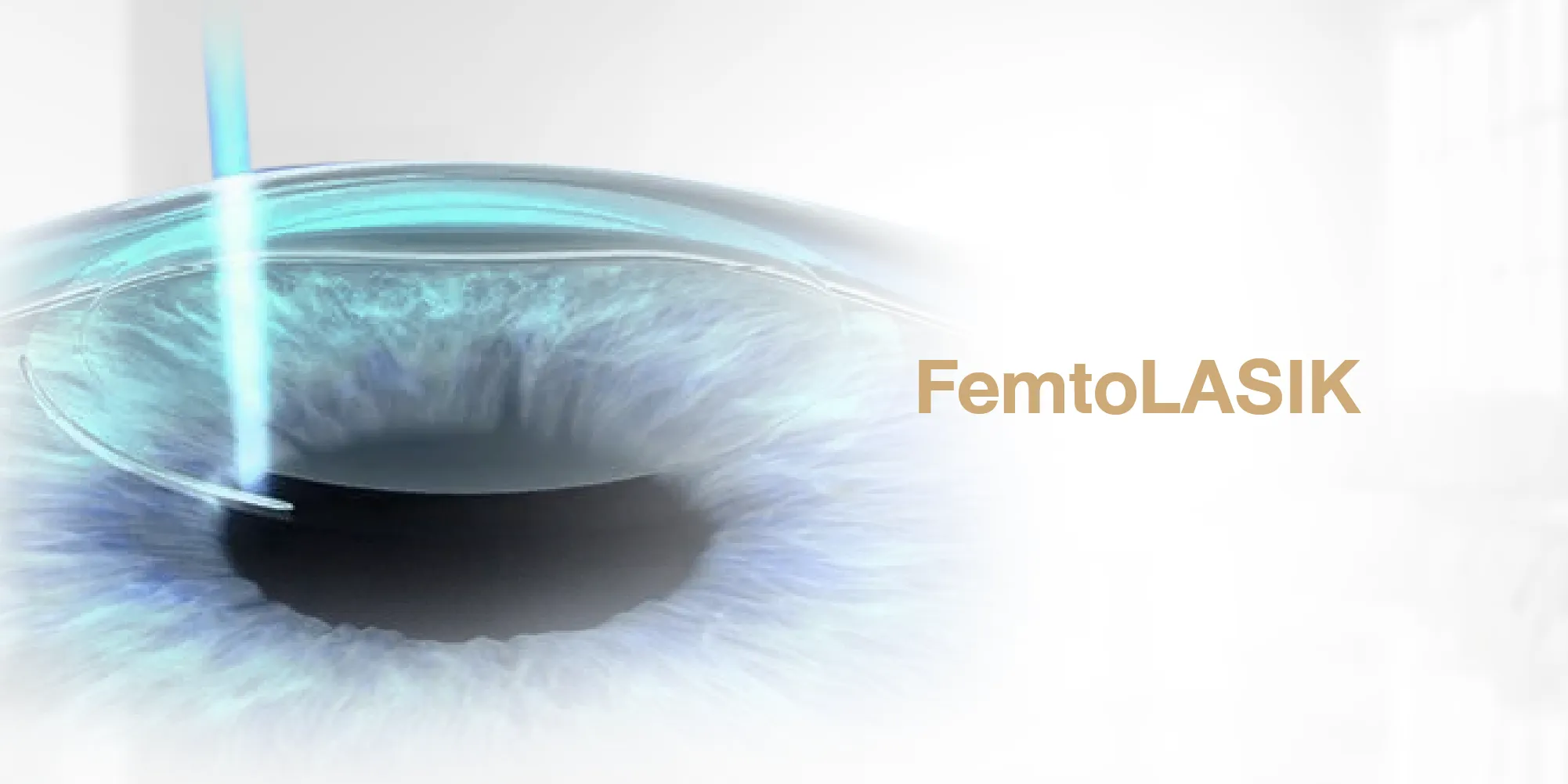 FemtoLASIK