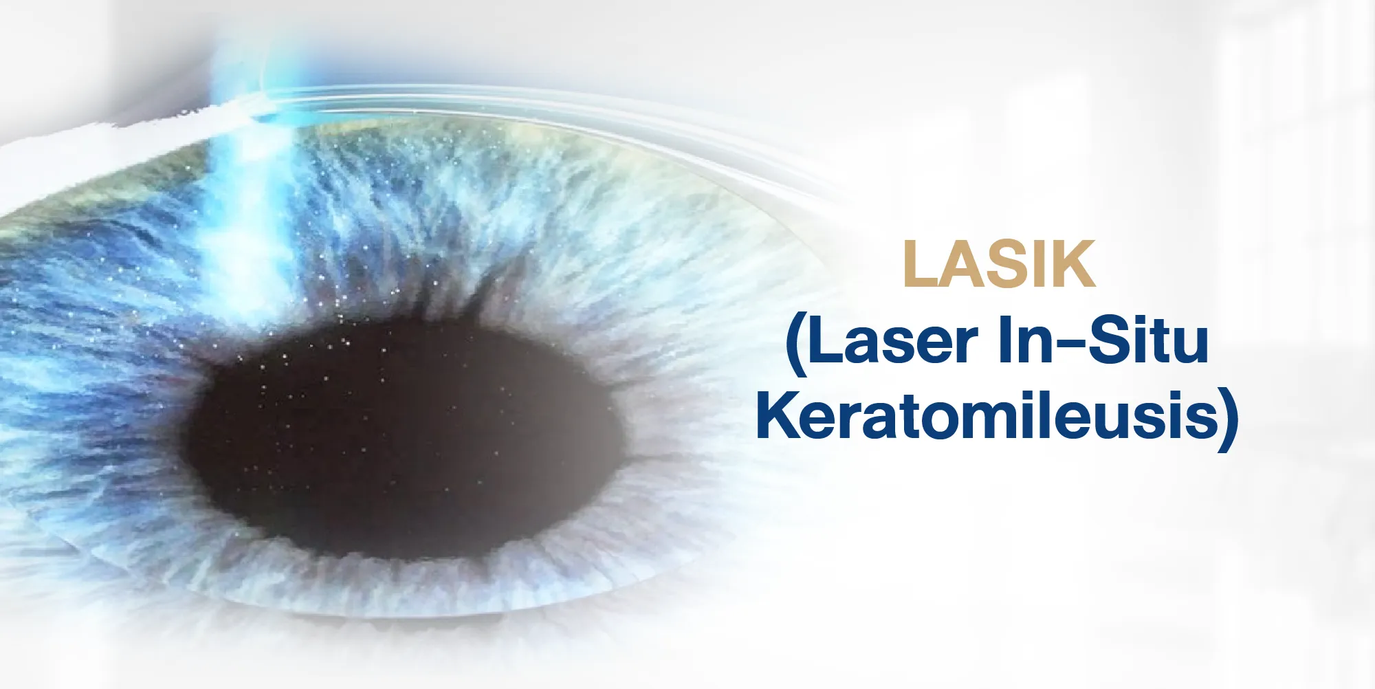 LASIK (Laser In-Situ Keratomileusis)