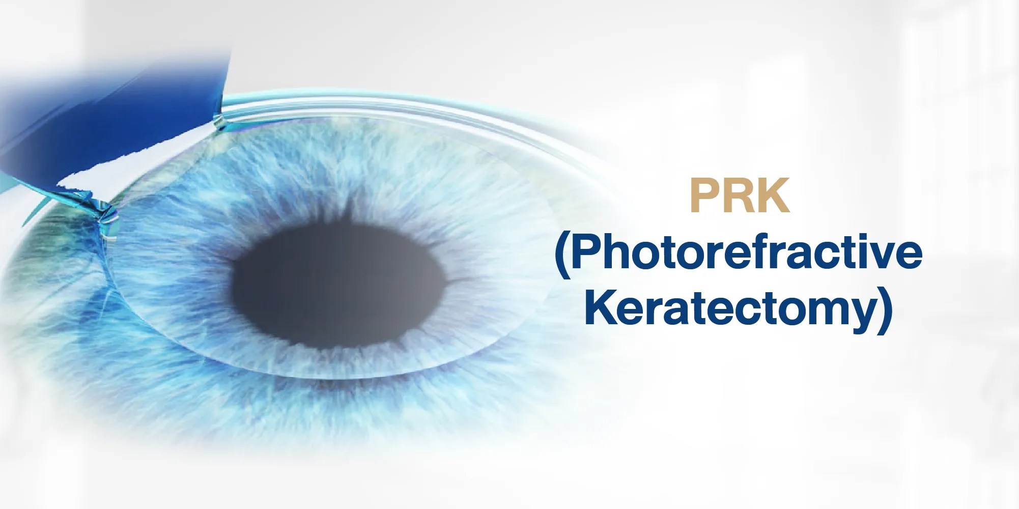 PRK (Photorefractive Keratectomy)