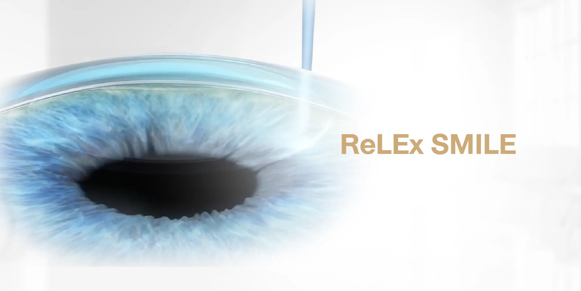 ReLEx SMILE