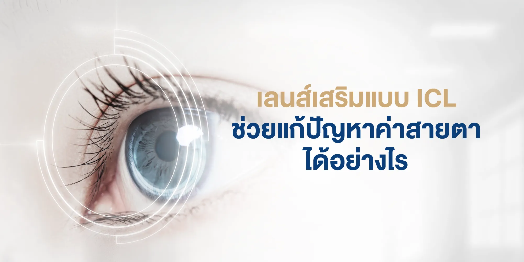 เลนส์เสริมแบบ ICL